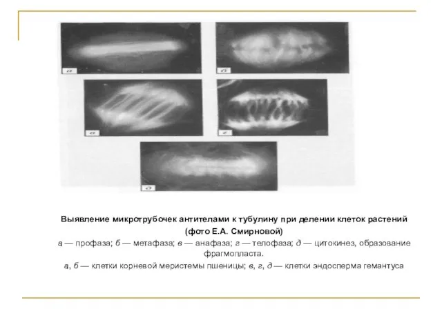 Выявление микротрубочек антителами к тубулину при делении клеток растений (фото Е.А.