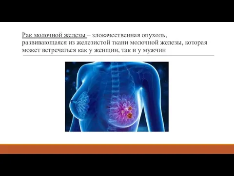 Рак молочной железы – злокачественная опухоль, развивающаяся из железистой ткани молочной