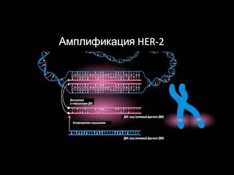 Амплификация HER-2