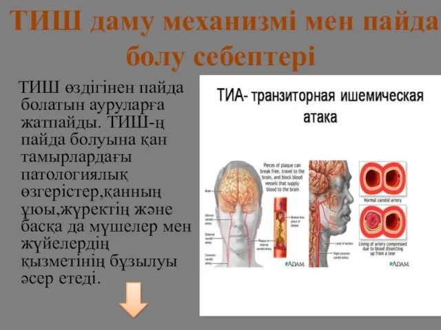 ТИШ өздігінен пайда болатын ауруларға жатпайды. ТИШ-ң пайда болуына қан тамырлардағы