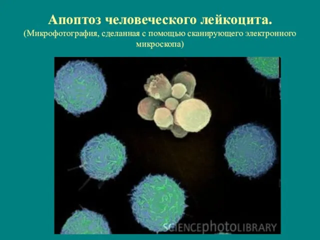 Апоптоз человеческого лейкоцита. (Микрофотография, сделанная с помощью сканирующего электронного микроскопа)