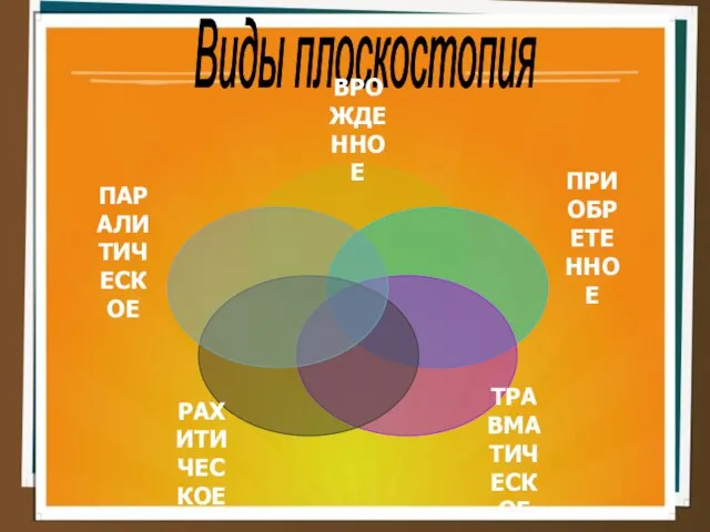 Виды плоскостопия