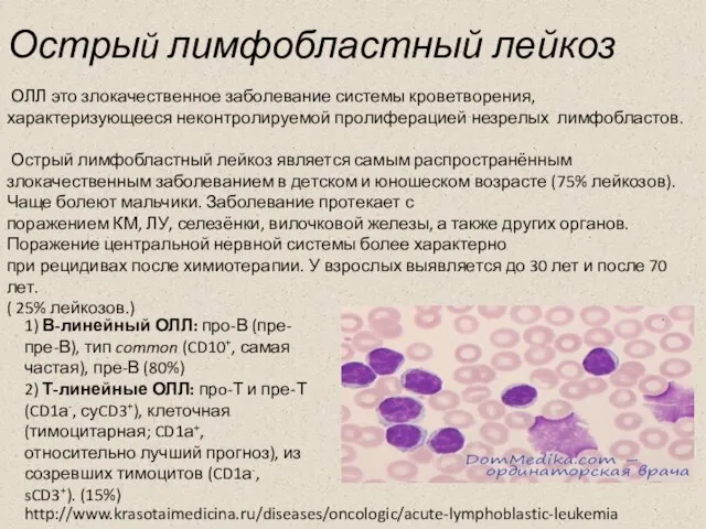 Острый лимфобластный лейкоз ОЛЛ это злокачественное заболевание системы кроветворения, характеризующееся неконтролируемой