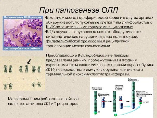 При патогенезе ОЛЛ В костном мозге, периферической крови и в других