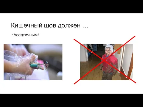 Кишечный шов должен … Асептичным!