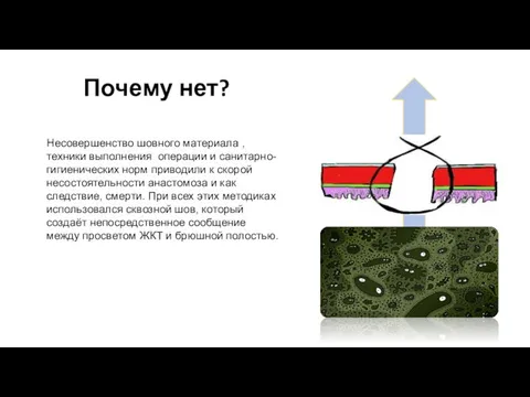 Почему нет? Несовершенство шовного материала , техники выполнения операции и санитарно-гигиенических