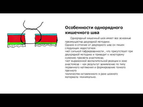 Особенности однорядного кишечного шва Однорядный кишечный шов имеет все основные преимущества