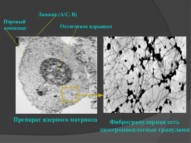 Препарат ядерного матрикса Фиброгранулярная сеть эдектронноплотные гранулами Остаточное ядрышко Ламина (A/C, B) Поровый комплекс