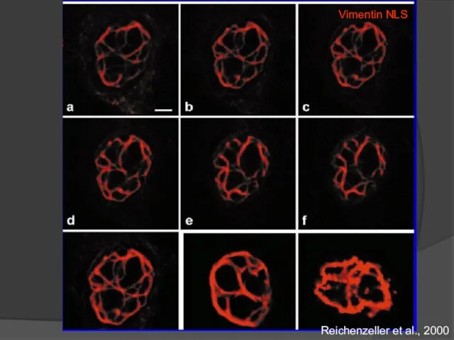 Vimentin NLS Reichenzeller et al., 2000