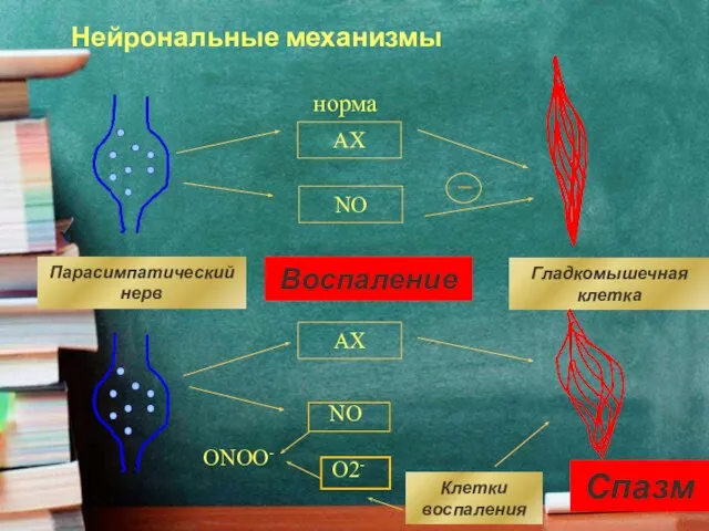 норма Воспаление АХ NO Парасимпатический нерв Гладкомышечная клетка АХ NO ОNOО-