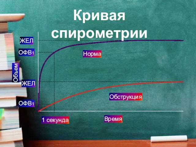 Норма Обструкция Время 1 секунда ОФВ1 ЖЕЛ ЖЕЛ ОФВ1 Объем Кривая спирометрии