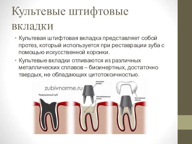 Культевые штифтовые вкладки Культевая штифтовая вкладка представляет собой протез, который используется