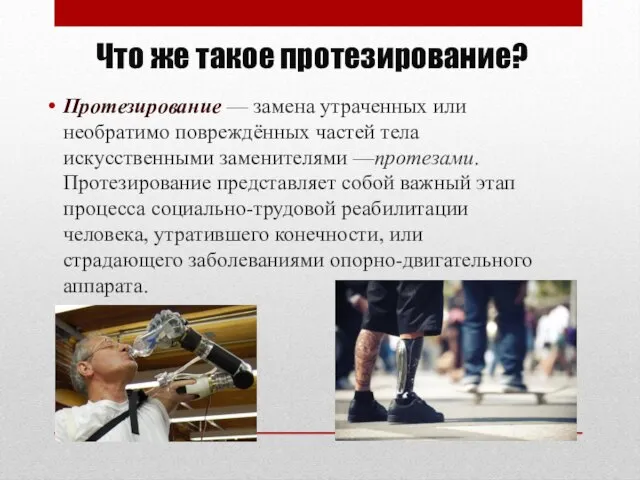 Что же такое протезирование? Протезирование — замена утраченных или необратимо повреждённых