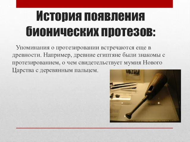 История появления бионических протезов: Упоминания о протезировании встречаются еще в древности.