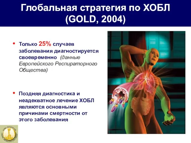 Глобальная стратегия по ХОБЛ (GOLD, 2004) Только 25% случаев заболевания диагностируется