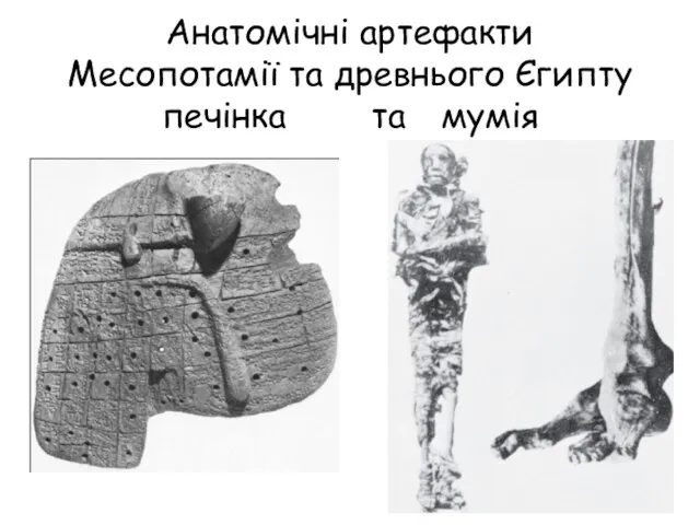 Анатомічні артефакти Месопотамії та древнього Єгипту печінка та мумія