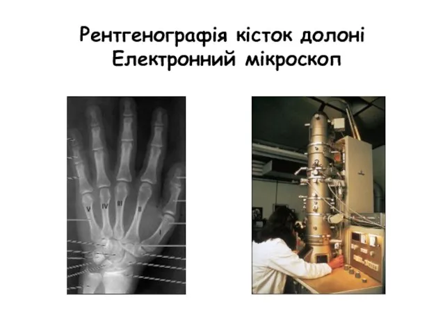 Рентгенографія кісток долоні Електронний мікроскоп
