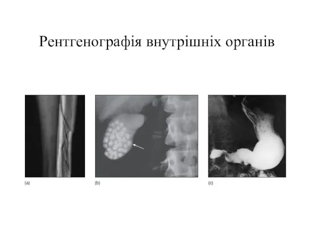 Рентгенографія внутрішніх органів