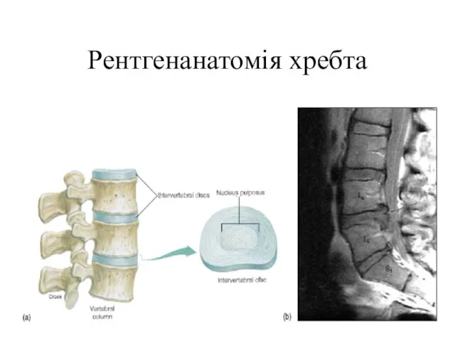 Рентгенанатомія хребта