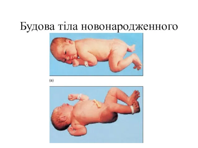 Будова тіла новонародженного