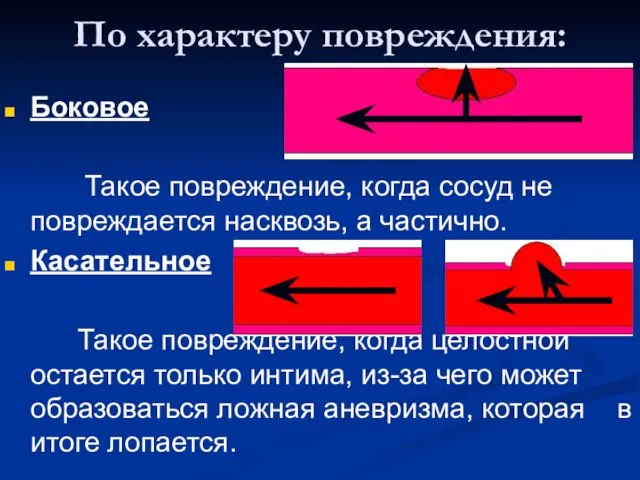 По характеру повреждения: Боковое Такое повреждение, когда сосуд не повреждается насквозь,