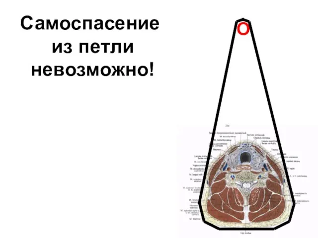 Самоспасение из петли невозможно! О