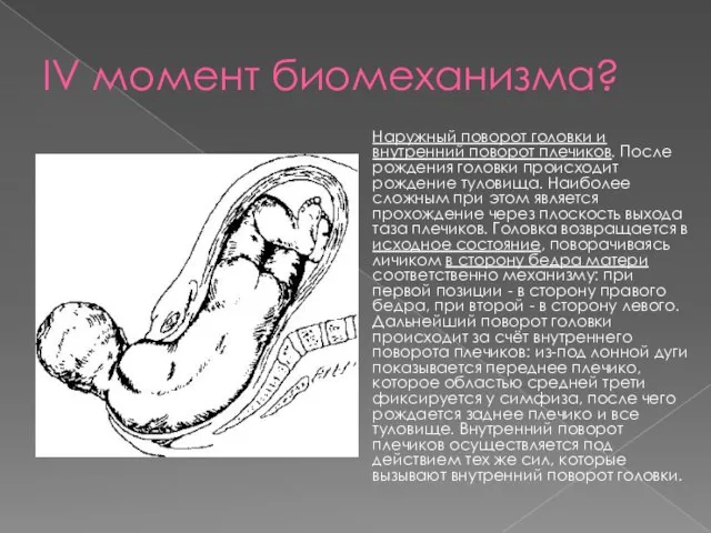 IV момент биомеханизма? Наружный поворот головки и внутренний поворот плечиков. После