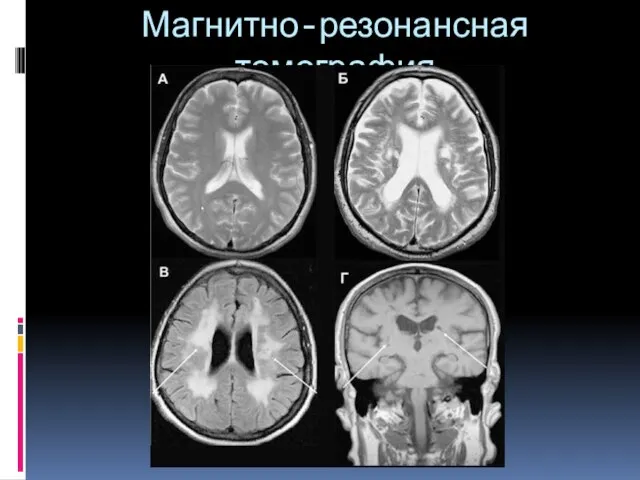 Магнитно-резонансная томография