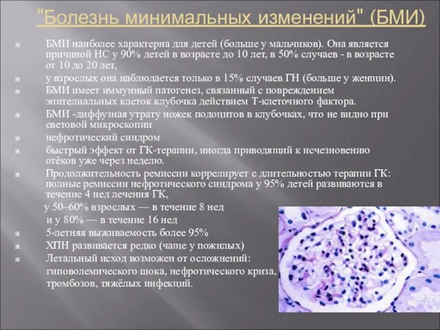 "Болезнь минимальных изменений" (БМИ) БМИ наиболее характерна для детей (больше у