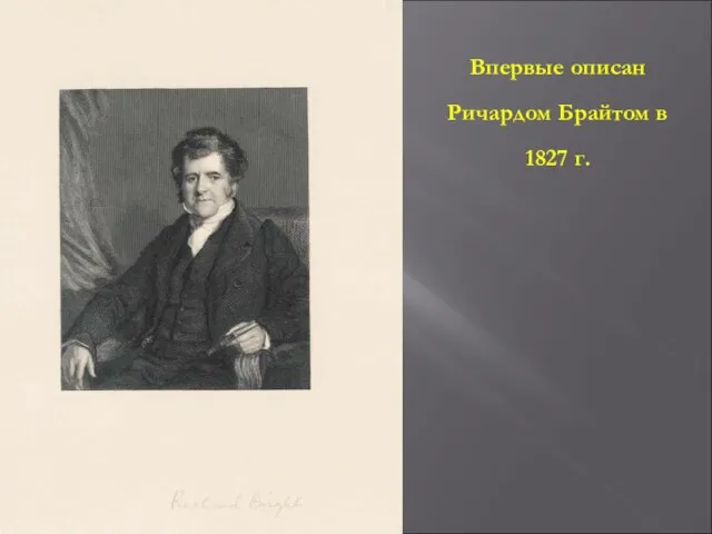 Впервые описан Ричардом Брайтом в 1827 г.