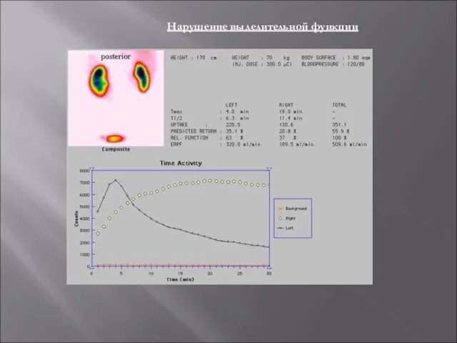 Нарушение выделительной функции