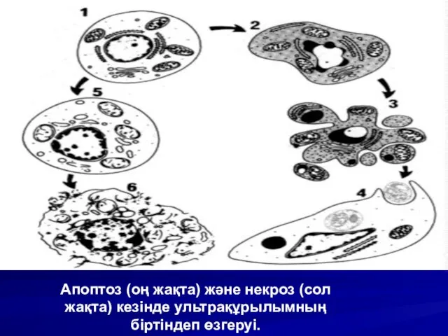 Апоптоз (оң жақта) және некроз (сол жақта) кезінде ультрақұрылымның біртіндеп өзгеруі.