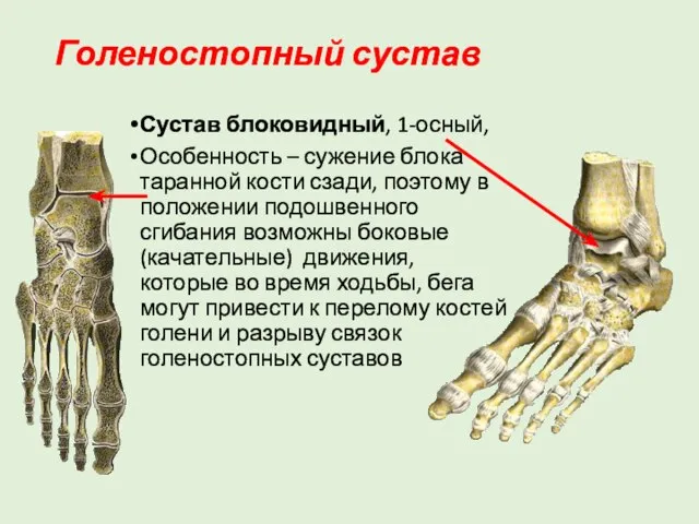 Голеностопный сустав Сустав блоковидный, 1-осный, Особенность – сужение блока таранной кости