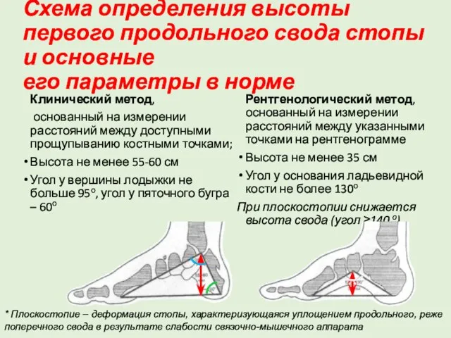 Схема определения высоты первого продольного свода стопы и основные его параметры