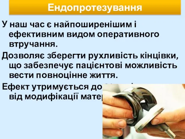 Ендопротезування У наш час є найпоширенішим і ефективним видом оперативного втручання.