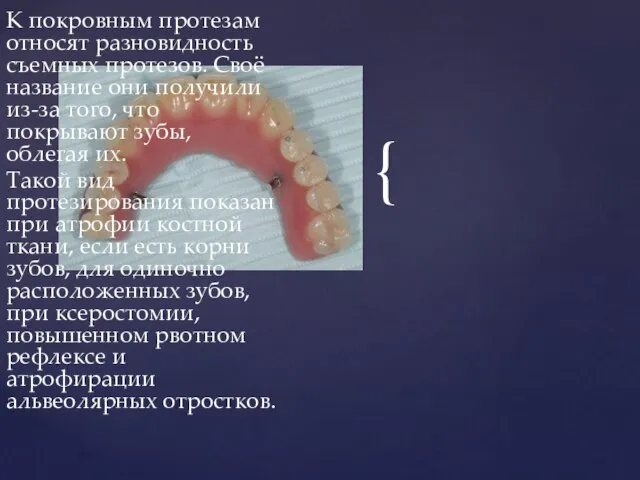 К покровным протезам относят разновидность съемных протезов. Своё название они получили