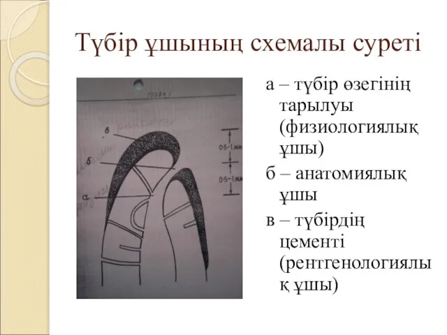 Түбір ұшының схемалы суреті а – түбір өзегінің тарылуы (физиологиялық ұшы)