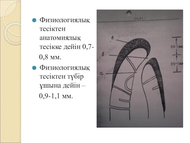 Физиологиялық тесіктен анатомиялық тесікке дейін 0,7- 0,8 мм. Физиологиялық тесіктен түбір ұшына дейін – 0,9-1,1 мм.