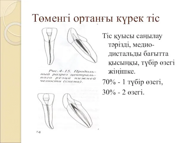 Төменгі ортанғы күрек тіс Тіс қуысы саңылау тәрізді, медио-дистальды бағытта қысыңқы,