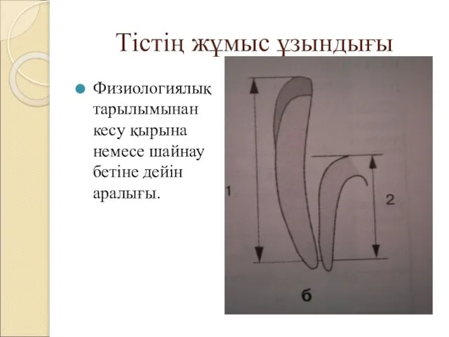 Тістің жұмыс ұзындығы Физиологиялық тарылымынан кесу қырына немесе шайнау бетіне дейін аралығы.