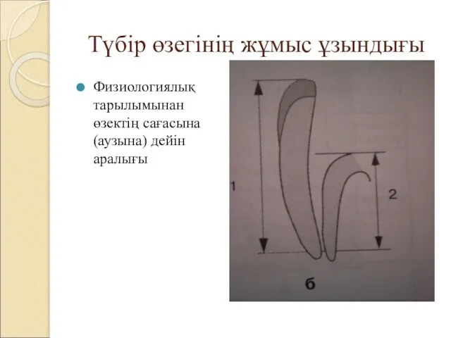 Түбір өзегінің жұмыс ұзындығы Физиологиялық тарылымынан өзектің сағасына (аузына) дейін аралығы