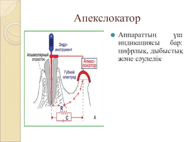 Апекслокатор Аппараттың үш индикациясы бар: цифрлық, дыбыстық және сәулелік