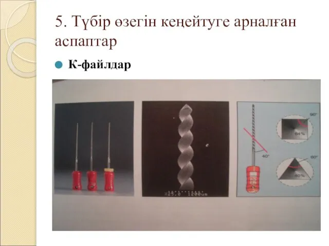 5. Түбір өзегін кеңейтуге арналған аспаптар К-файлдар