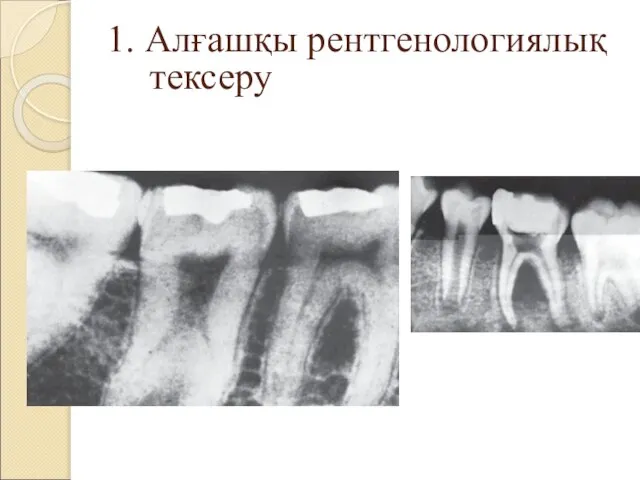 1. Алғашқы рентгенологиялық тексеру