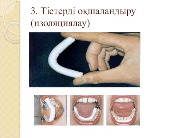 3. Тістерді оқшаландыру (изоляциялау)