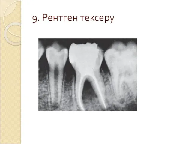 9. Рентген тексеру