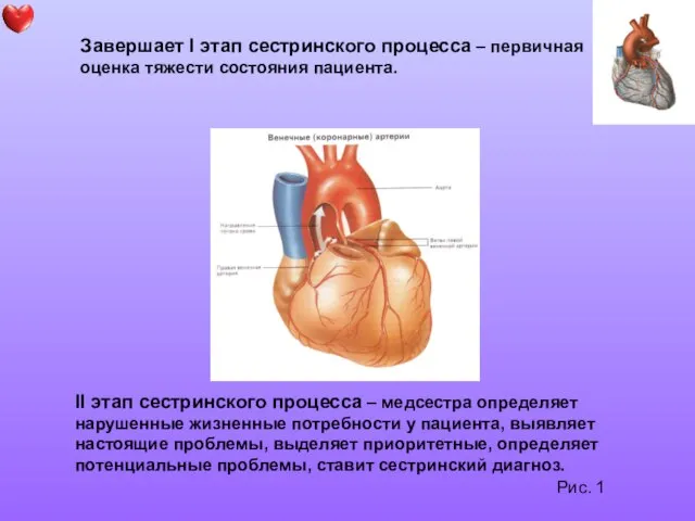 Рис. 1 Завершает I этап сестринского процесса – первичная оценка тяжести