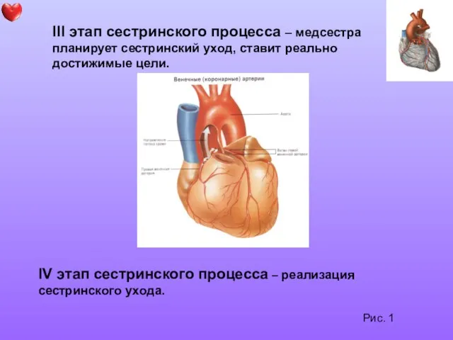 Рис. 1 III этап сестринского процесса – медсестра планирует сестринский уход,