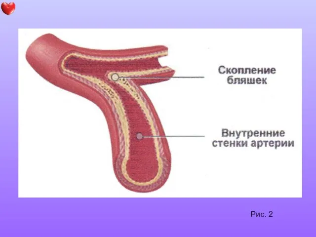 Рис. 2