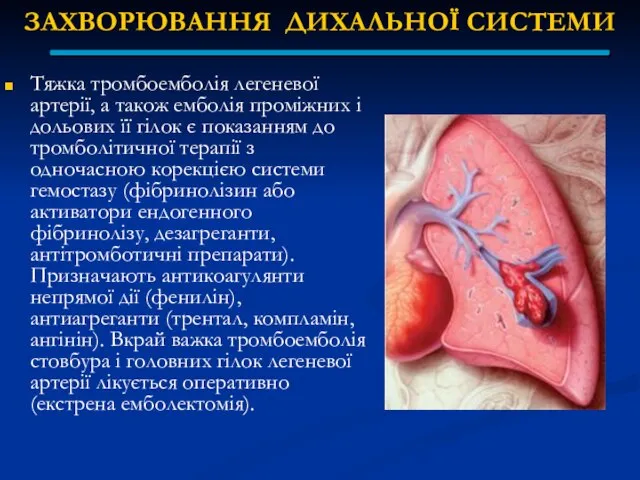 ЗАХВОРЮВАННЯ ДИХАЛЬНОЇ СИСТЕМИ Тяжка тромбоемболія легеневої артерії, а також емболія проміжних